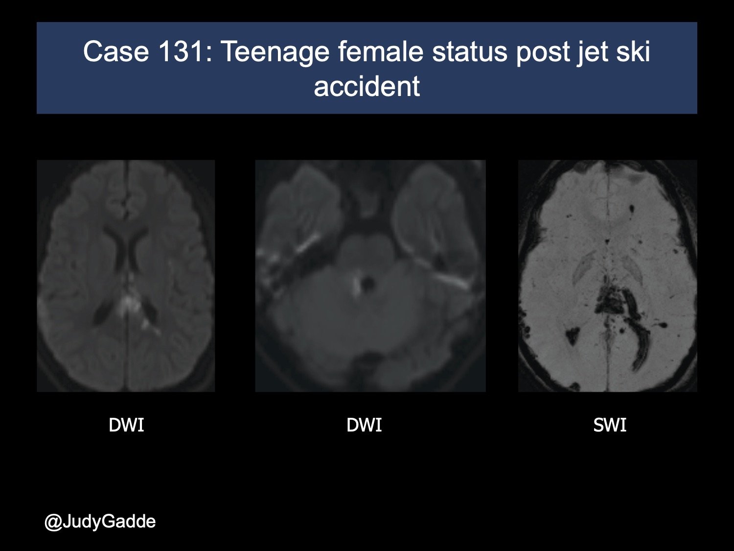 Lurie Twitter Case 13 edited 1.jpg