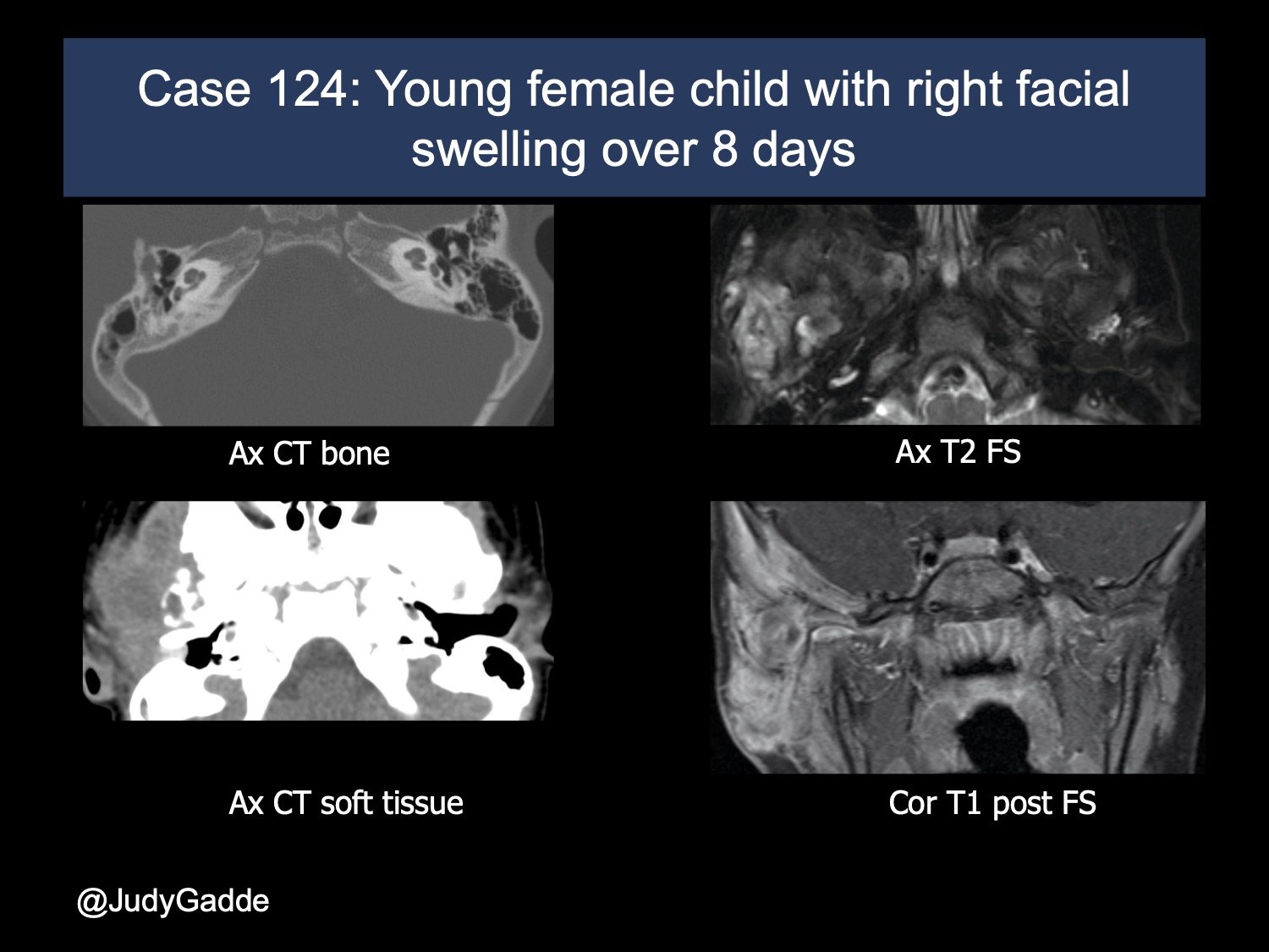 Lurie Twitter Case 6 updated 1.jpg