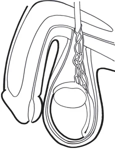 epididymiscyste.jpg