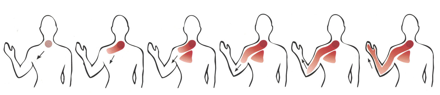 Is It Really Your Shoulder?