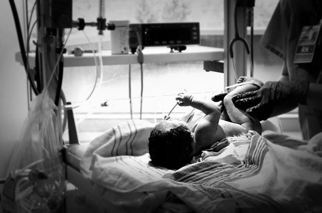 In honor of #WorldDoulaWeek Day Five, I’d like to share my top 5 most memorable Doula moments with you!✨✨✨✨✨
.
1) The moment this little rainbow was born. Her mama is the strongest woman I’ve ever known. We were all waiting with abated breath for her arrival. Cautiously optimistic. Then she came. Her mama roared her into the world with the fervor of all the fear and pain she had endured through the years to bring her Earthside. With that first big breath, her sweet girl cried out towards her sisters in heaven. She was here, and there wasn’t a dry eye in the room. 🌈
.
2) When a first time mama birthed on all fours, with the hospital bed raised in the air. Dad caught the baby as her Midwife stood close by and assisted. “IT’S A BOY!” We all learned for the first time, as a proud father raised his new son in the air and passed him to his mother’s open arms. 🤱🏻
.
3) “I JUST PEED ALL OVER YOU!” this laboring mama said to me in horror. As I lay down chux pads, I laugh to myself and say “actually, your water just broke.“ She couldn’t believe it. Her baby was born 2 hours later. ✨
.
4) A mama with a complex history birthing for the first time. Proudly clean from substance use and determined to do everything in her power to avoid pharmaceutical intervention. Her vulnerability and openness astounds me. Her ability to embrace the pain, and ride the waves. Her partner’s steadfast presence by her side. The look of concern on his face as she works through her pain. As she enters transition in the tub, I quietly alert the nurse that pushing will begin soon. “It’s a first birth, we have a bit longer” the nurse tells me. 45 minutes later, her sweet girl is nestled against her chest, staring into her Mama’s eyes as the moonlight shines through the room during the first snowfall of the new year. 🌝
.
5) “I’m really cold and can’t stop shaking.” A second time mama tells me through her quivering lips after receiving her requested epidural. I reassure her this is normal, grab more blankets, and turn her into a cozy mama burrito. She smiles up at me and says “thank you. Will you hold my hand and tell me corny jokes?” Yes. The answer is always yes. 💗
#thisisbirth #labor #empowerment