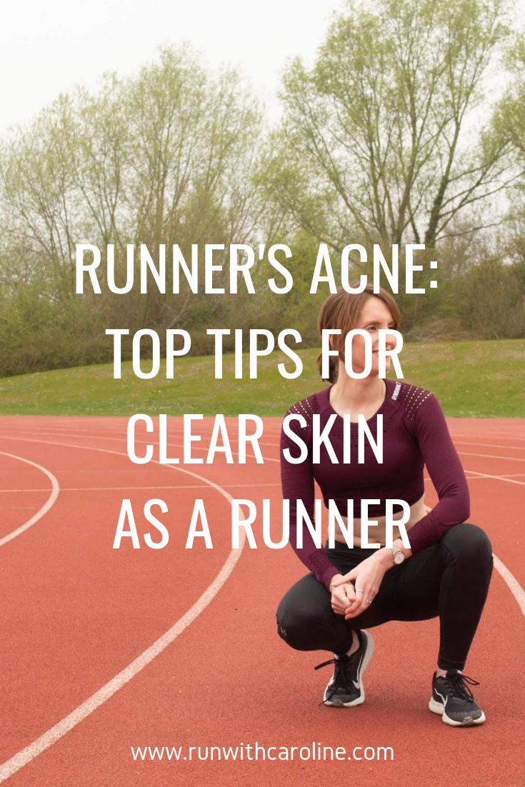 How to prevent runner acne