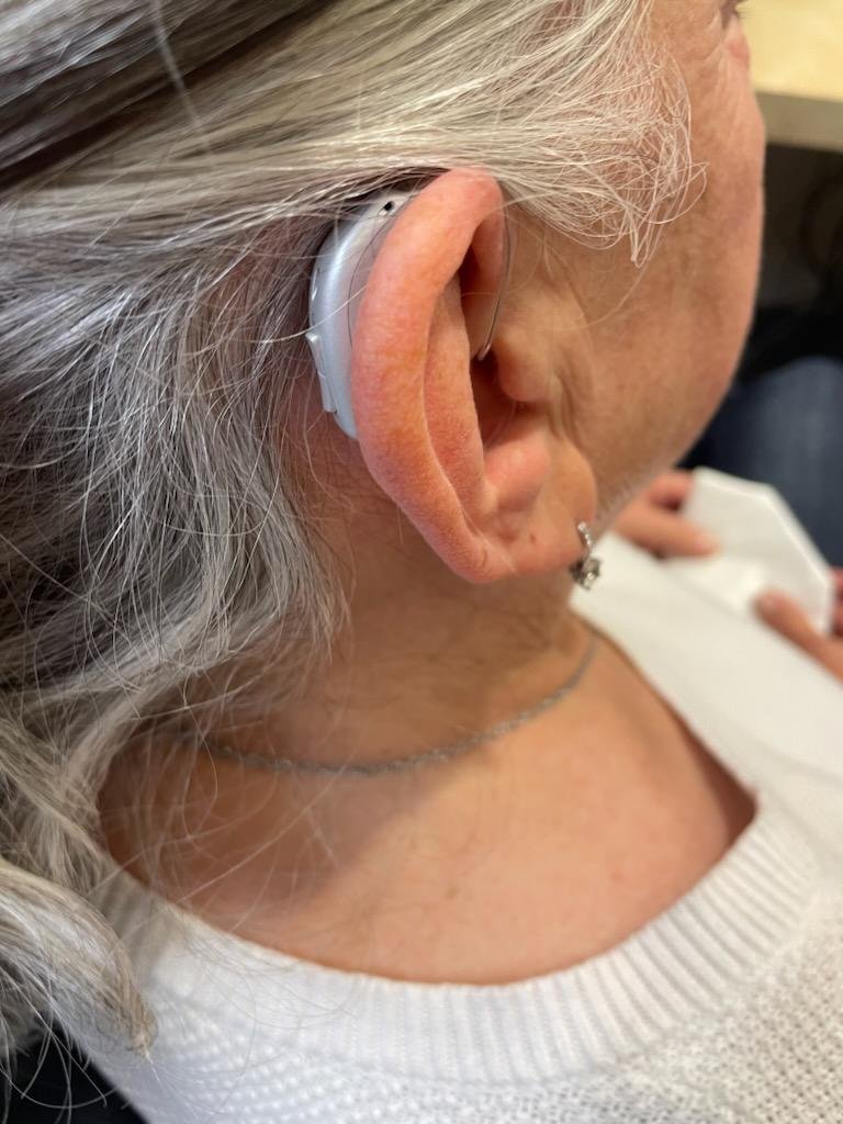 Hearing "Enhancements." An update