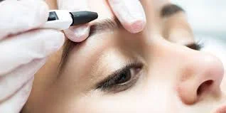 electrolysis.jpg