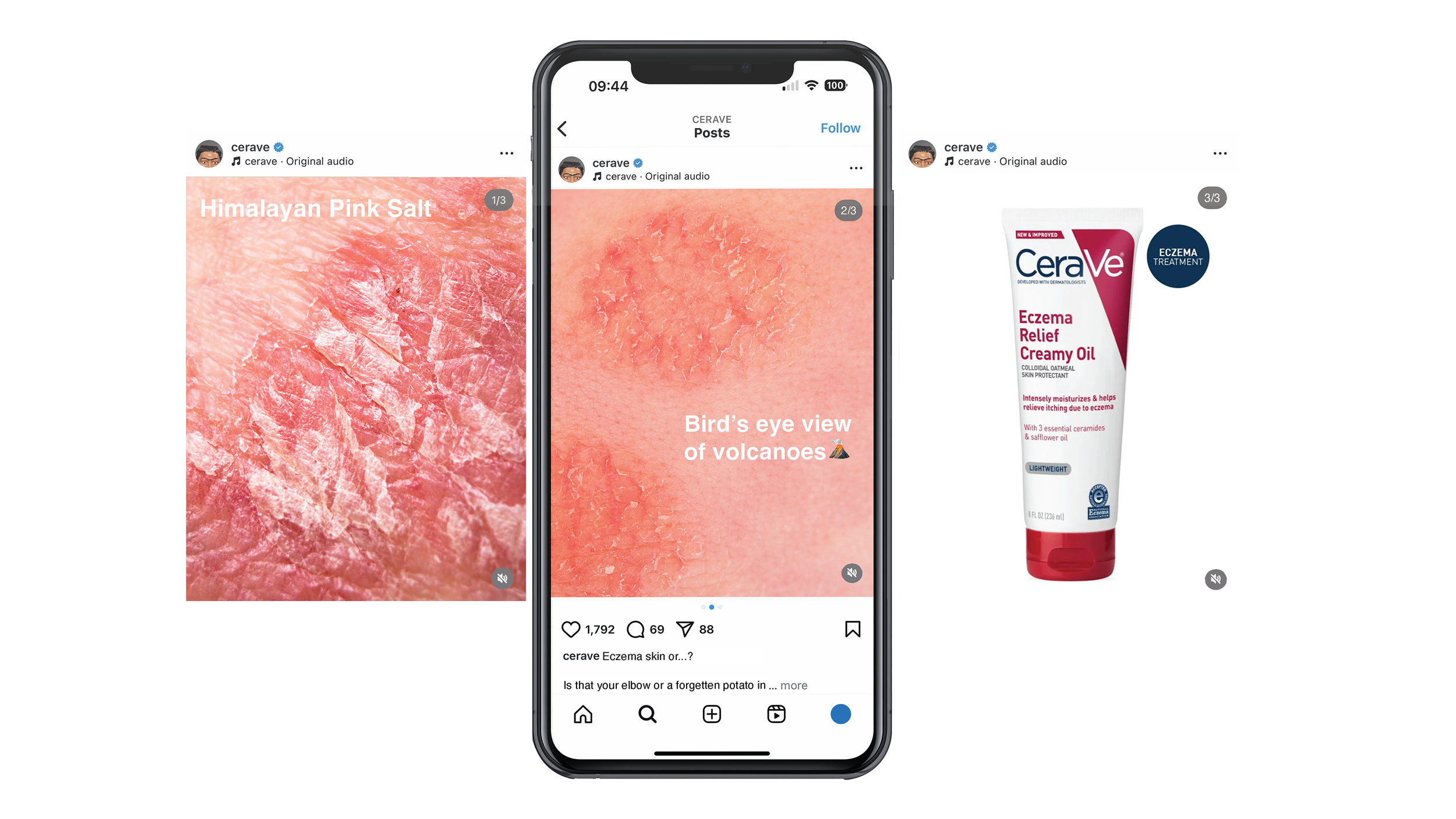 This instagram carousel gently pokes fun at eczema affected skin, followed by CeraVe gentle solution.