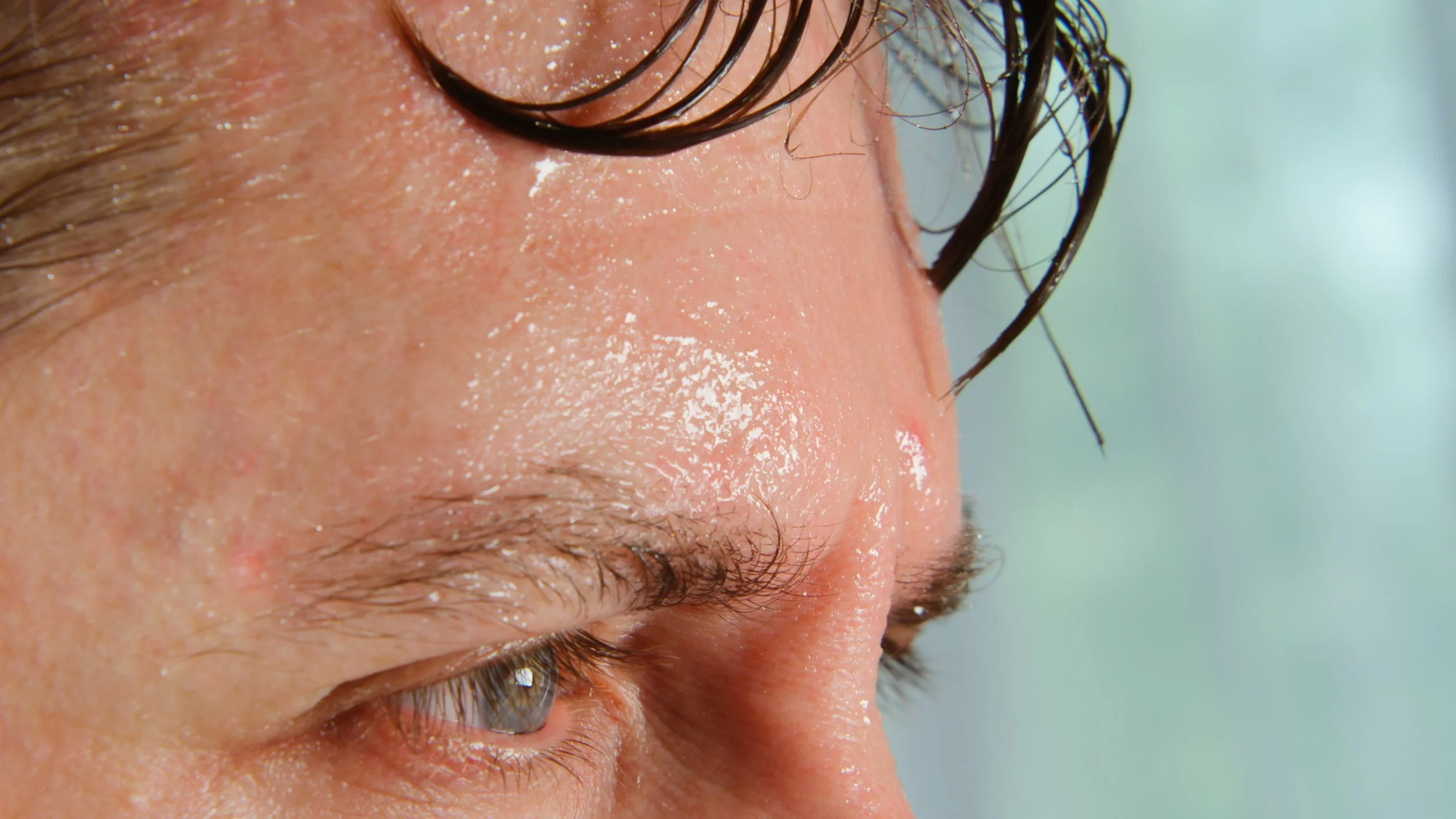 Extreme close-up of a person's sweaty forehead and eye.