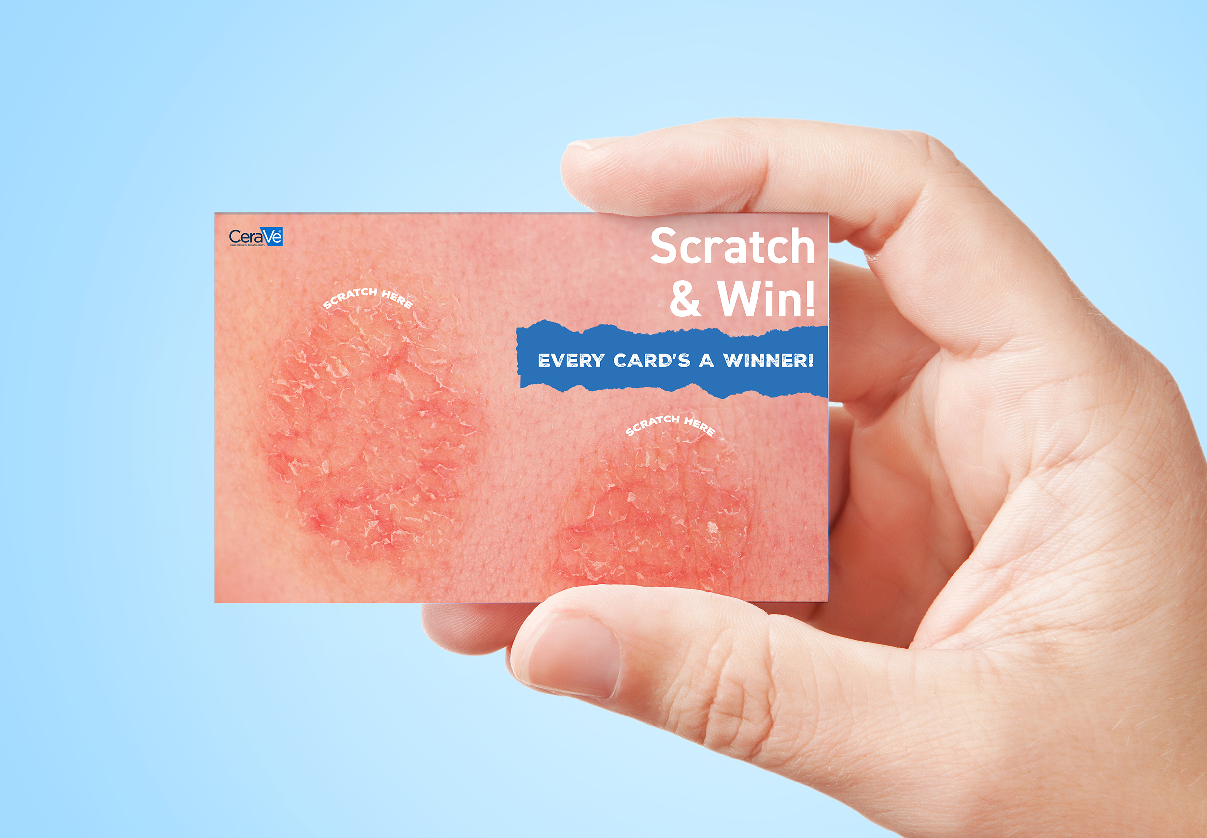 In print collateral, the scratch off lottery ticket soothes the itch you're not supposed to scratch, with CeraVe discounts.