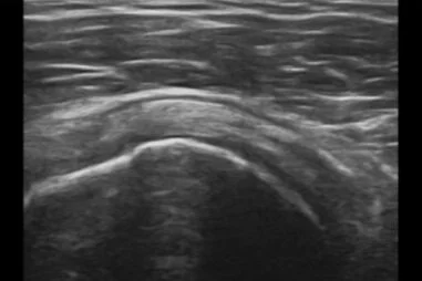 Diagnostic Ultrasound