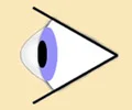 Renton+Vision+Clinic+Keratoconus.jpg