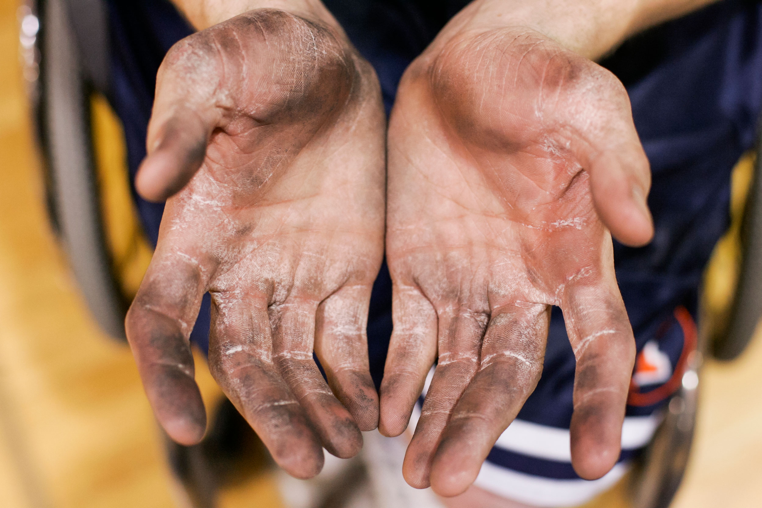 After playing two games in a row at a University of Wisconsin-Whitewater tournament, Denny Muha's hands show calluses, peeling skin, and caked-on dirt. His hands get so dirty from pushing his wheelchair so much. "Some courts are dirtier than others," Muha remarked.