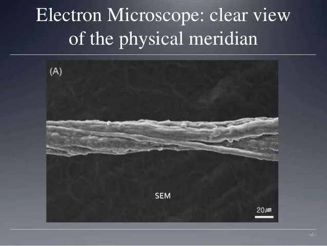 primo-vascularmeridian-system-2016-16-638.jpg