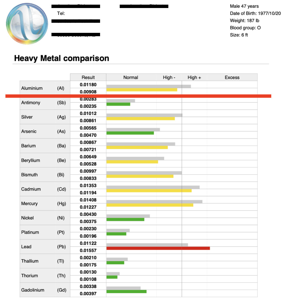 Aluminum, the Bone and Brain Breaker