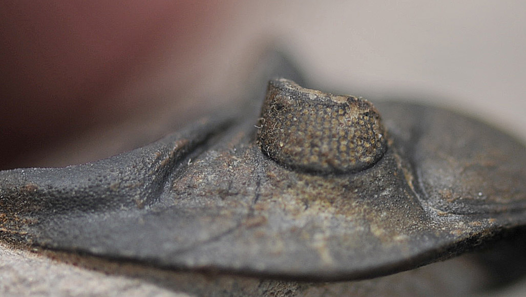 Right eye