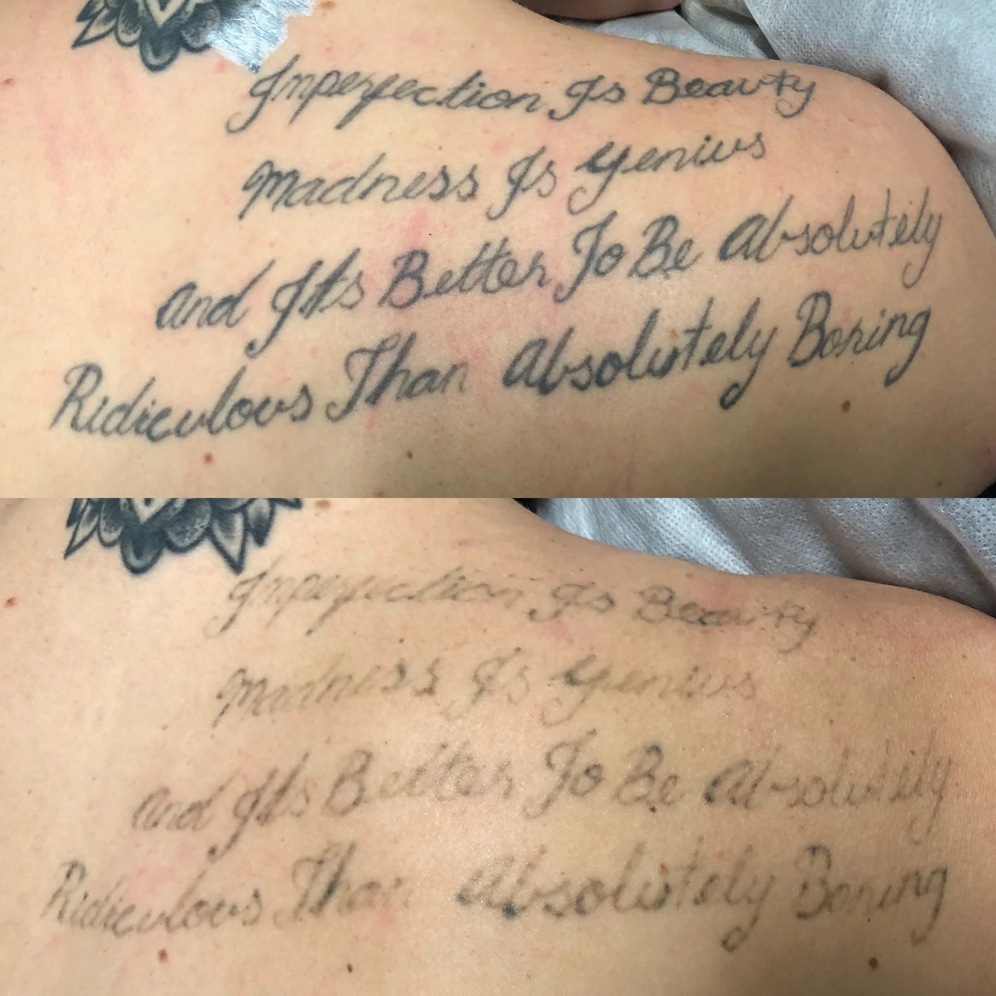 Imperfection Is Beauty Madness Is Genius Tattoo