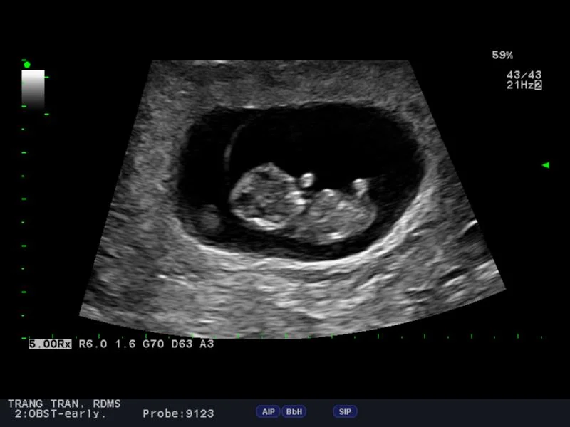 ANOTHER SISTER TO LOVE