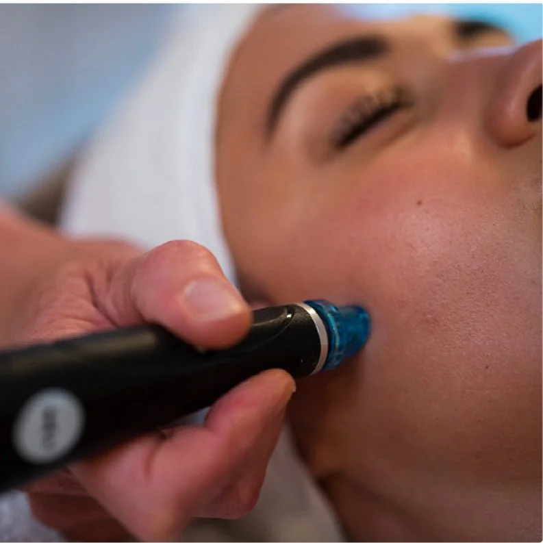  Get the HydraFacial glow 