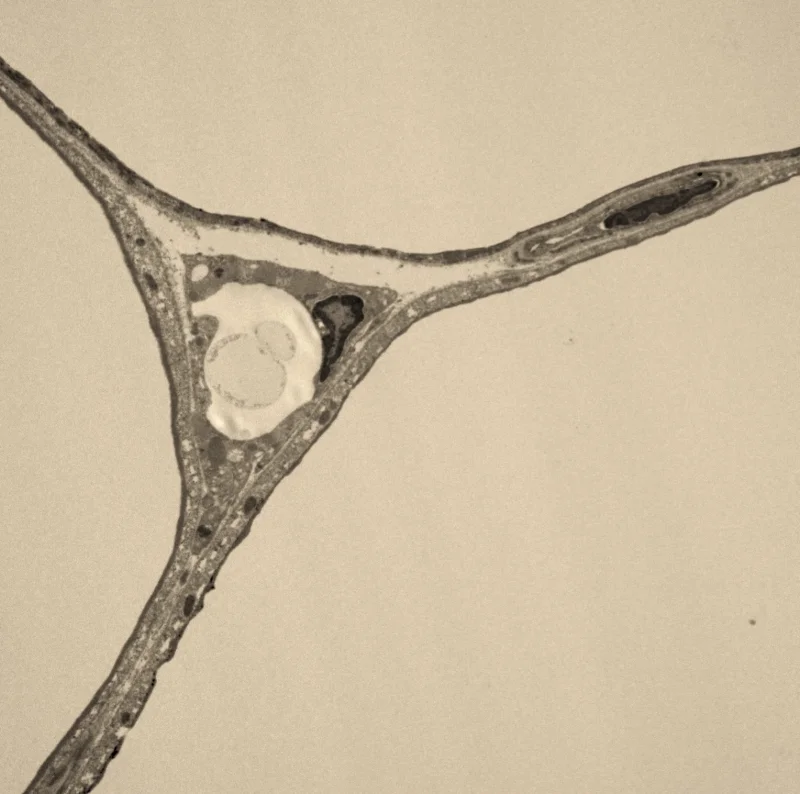 EM of Adipocytes.jpg