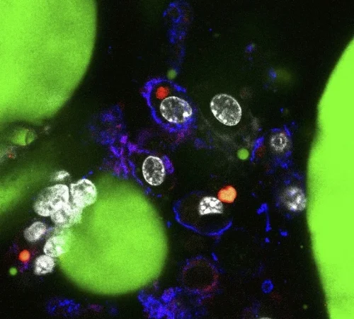 Live image of macrophages in adipose tissue - from Xiaoyuan Xu