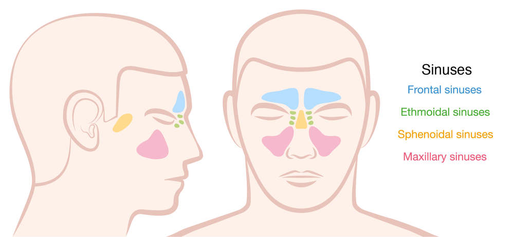 Chronic Sinusitis Chad Ruffin Md Chronic Sinusitis Chad Ruffin Md