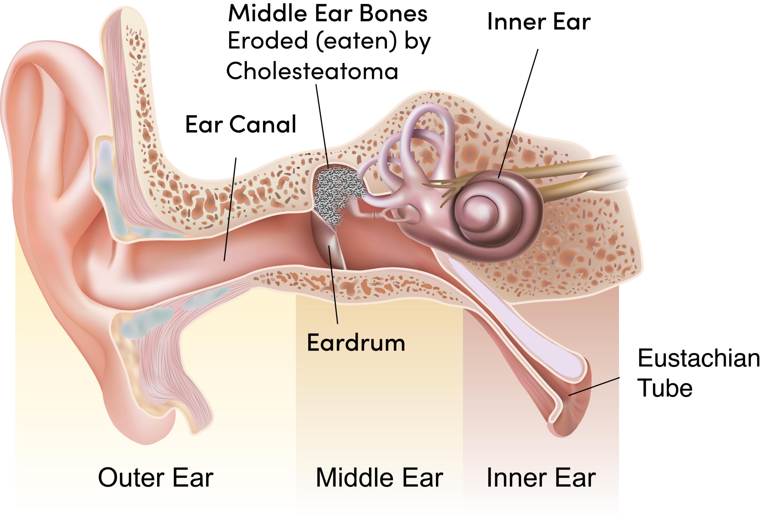 Ear drum