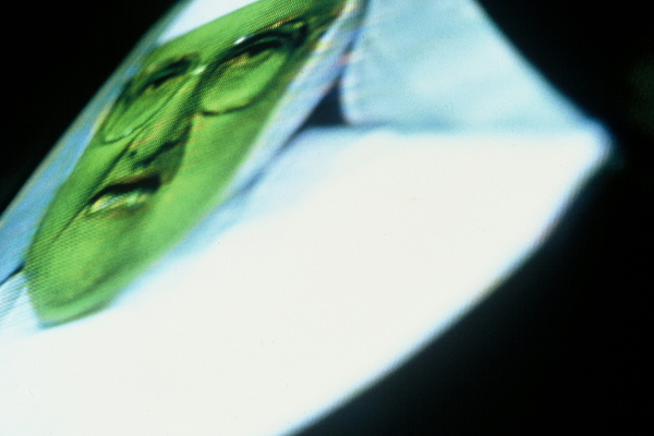 Diane Bush | Sick, so Sick... | photograph and audio | from the series, "500 Channels"