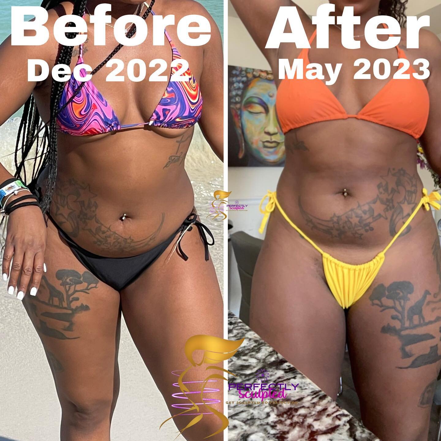 Body sculpting and eating better really has payed off . @perfectlysculptedwpb gets the job done every time. I&rsquo;m loving my results ✅‼️❤️ now I just have to start back working out 🏋🏾&zwj;♀️