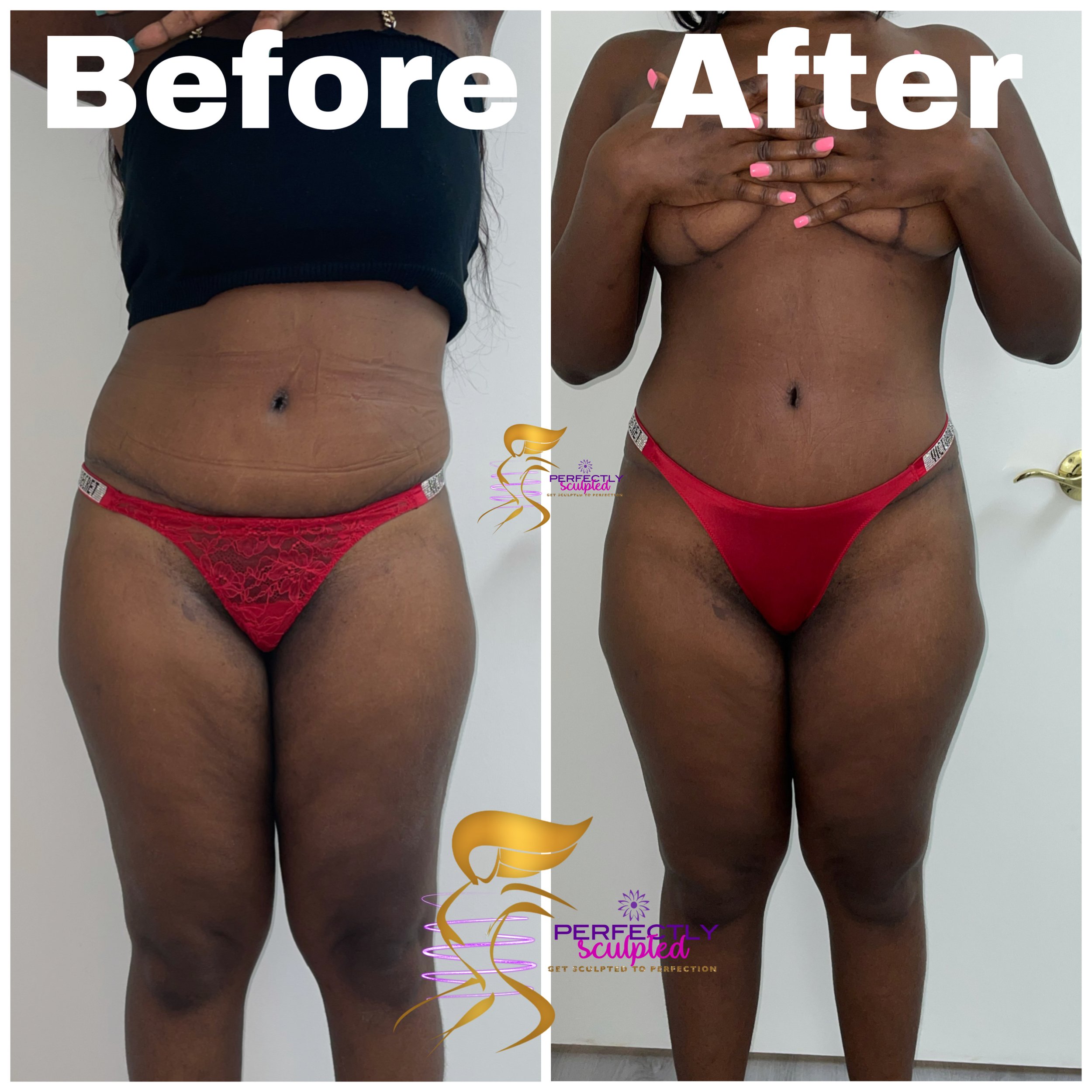 Perfectly sculpted WPB Body Sculpting, Waxing, And Facials