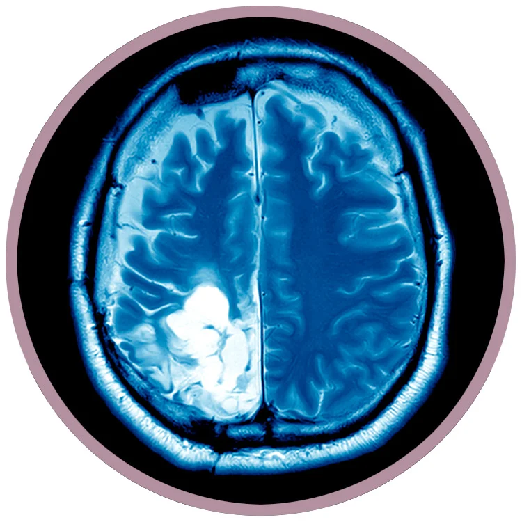 Brain-Scan.jpg