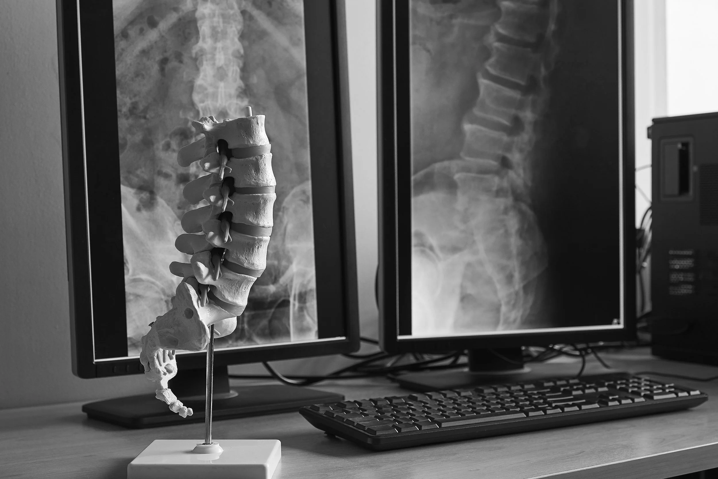 bigstock-Artificial-Human-Lumbar-Spine--251227744.jpg