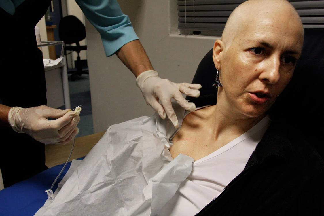 Chemo