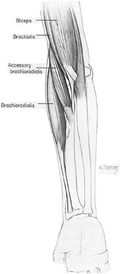 Accessory Brachioradial