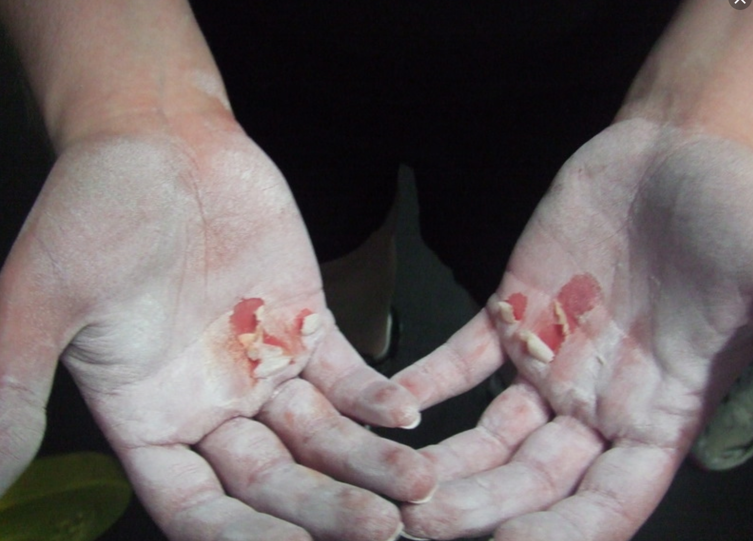 How To Prevent Hand Tears On Murph