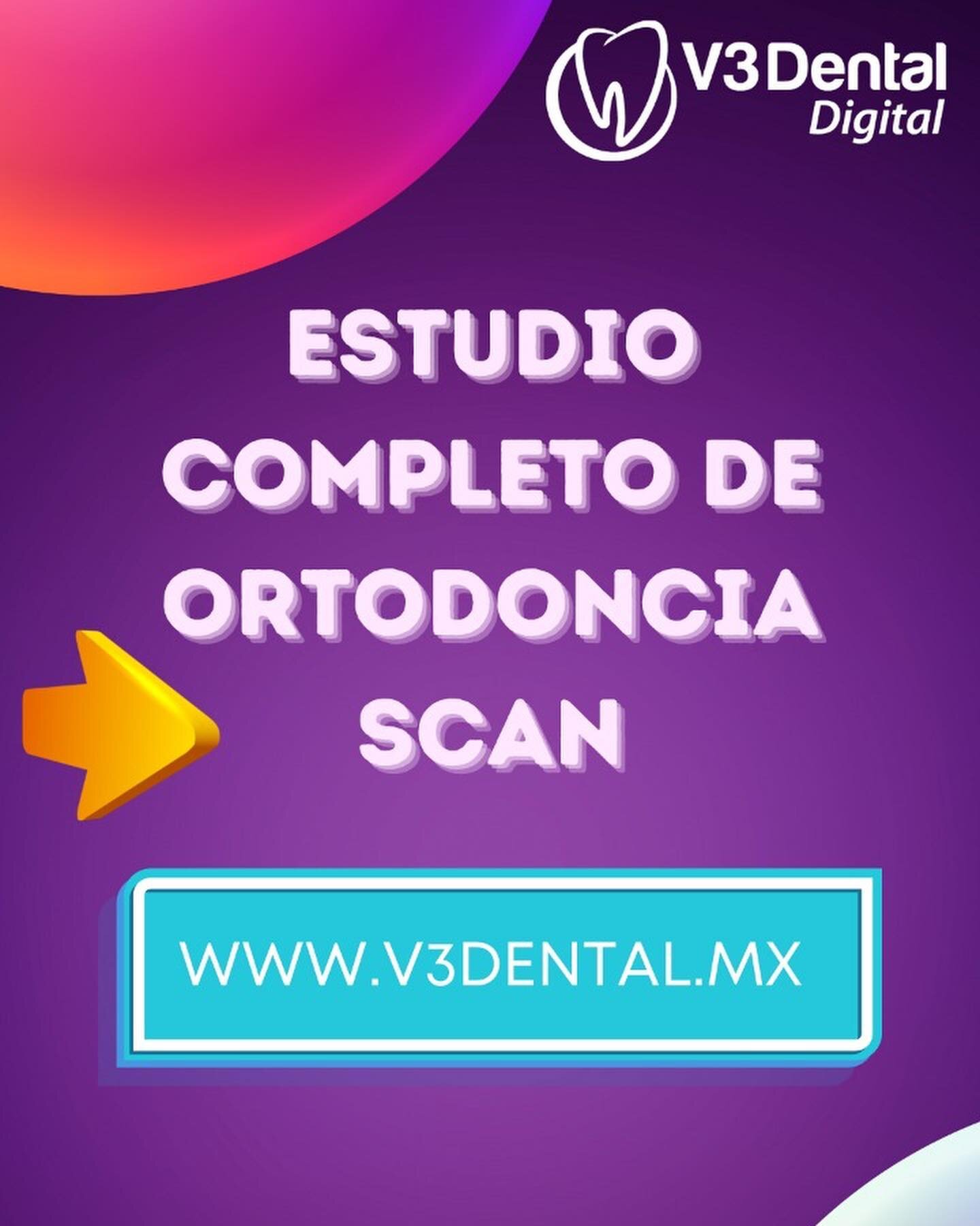 Introducimos los nuevos modelos 3D de V3Dental digital
Presentamo el nuevo Estudio Completo de Ortodoncia Digital Scan que incluye:  el escaneo virtual de los modelos en 3D archivo STL 

Asimismo ahora puedes solicitar &uacute;nicamente los modelos d