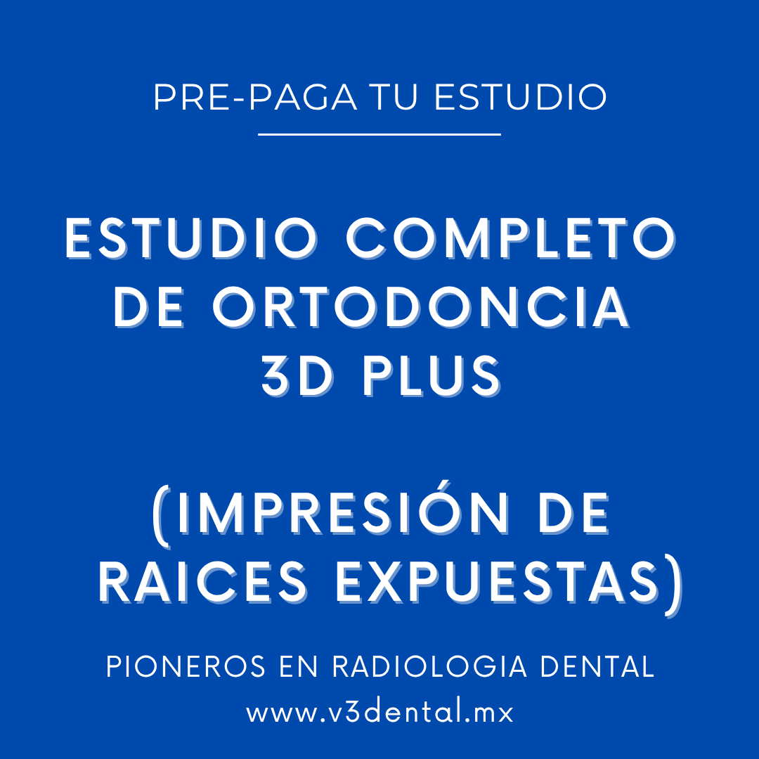 ESTUDIO COMPLETO DE ORTODONCIA DIGITAL 3D con modelos de raíces expuestas