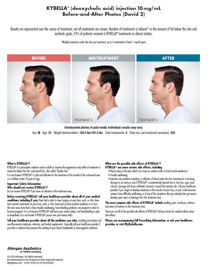 Kybella Before-and-After-David.jpeg