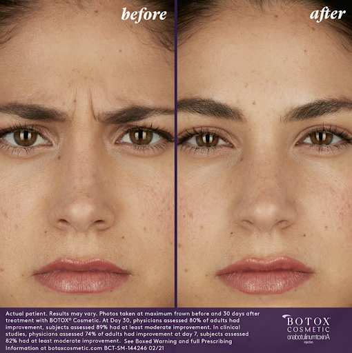 BOTOX-Cosmetic-Professional-Team-Diversity-BAs-Gia-3.png