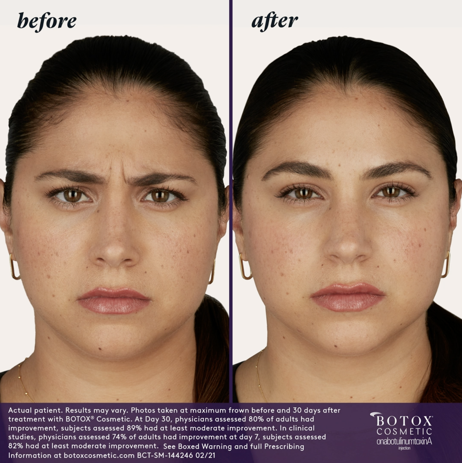 BOTOX-Cosmetic-Professional-Team-Diversity-BAs-Gia-2.png