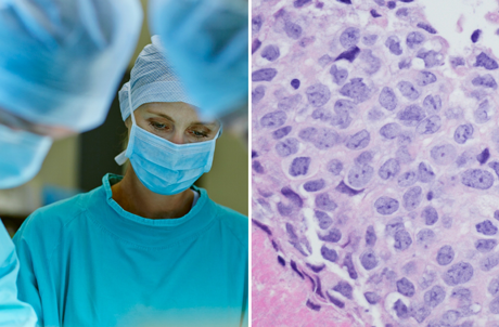  Iscaff Pharma - ny plattform för cancerdiagnostik och test av läkemedel