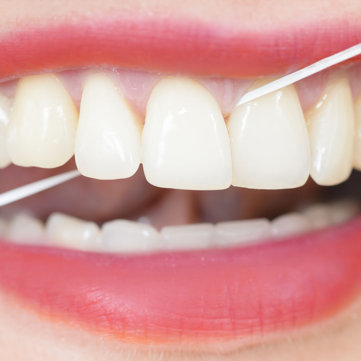 Synergy-floss-biddulph.jpg