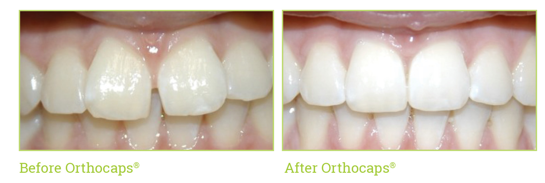 Case1_Before and After.jpg