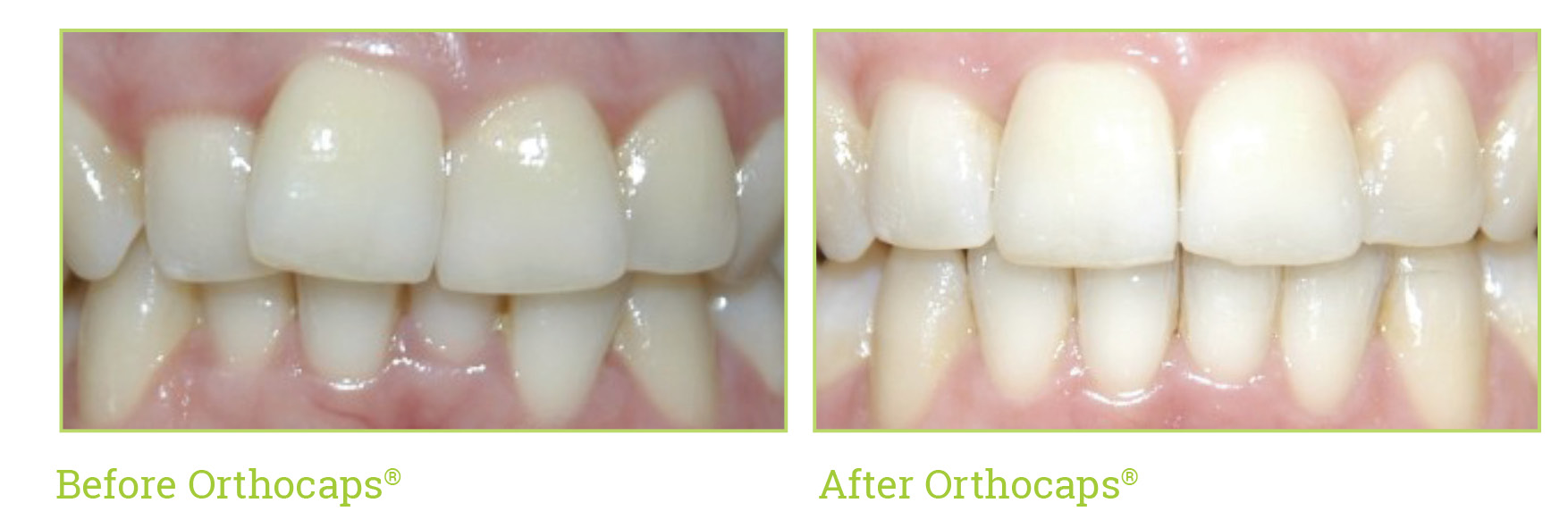 Case3_Before and After.jpg