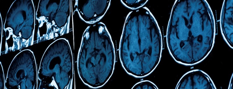 unknown source fMRI.jpg