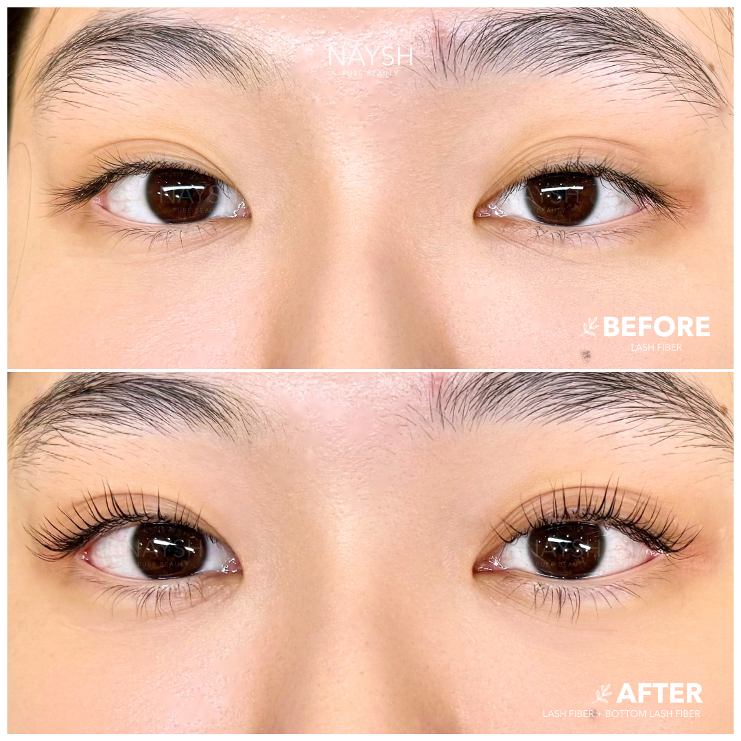 Website Assets - Before After LF 01.png