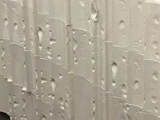 Chase Farm Hospital, Enfield