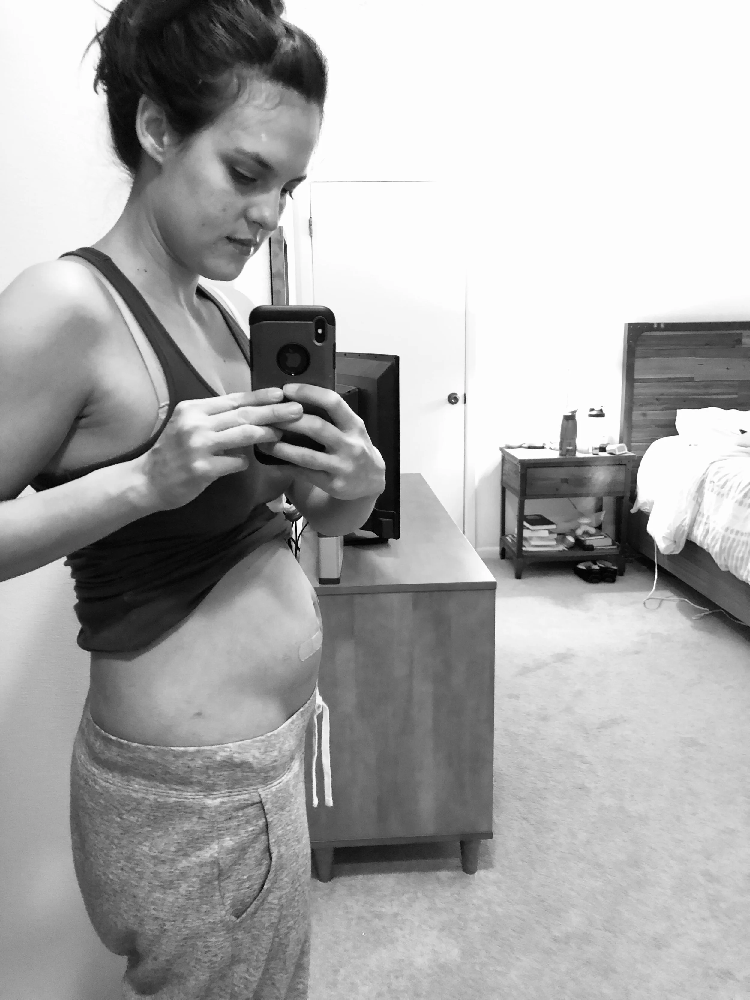 ‘Twas the night before the egg retrieval, when all through the house the bellies were bloated something something something spouse. (I’m tired, cut me some slack. Does anyone have a suggestion for what could go between bloated and spouse? Help a gir…