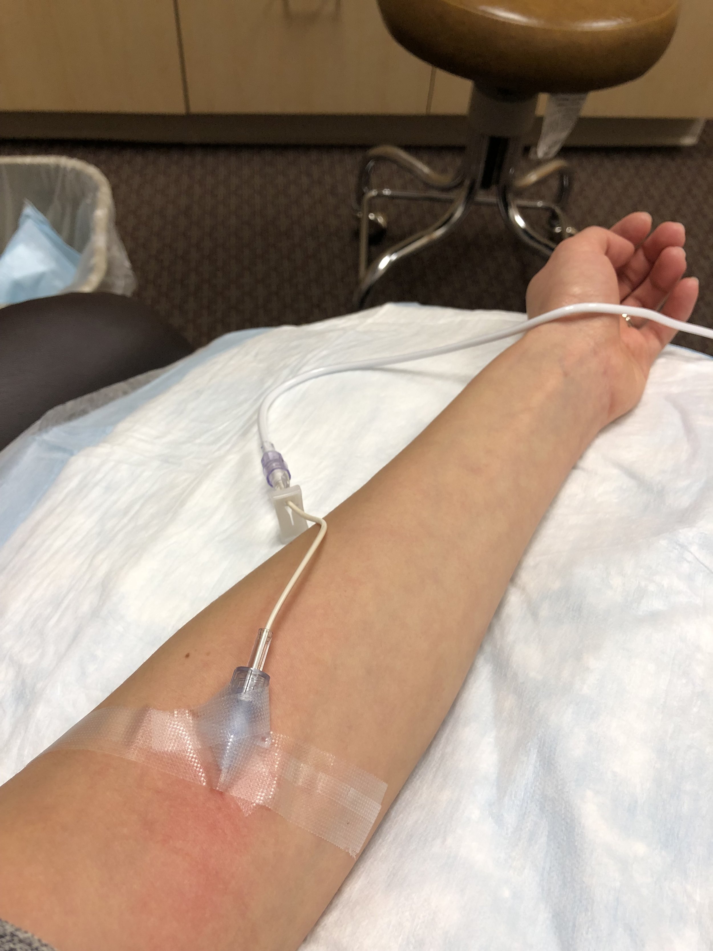 Intralipid infusion arm.jpg