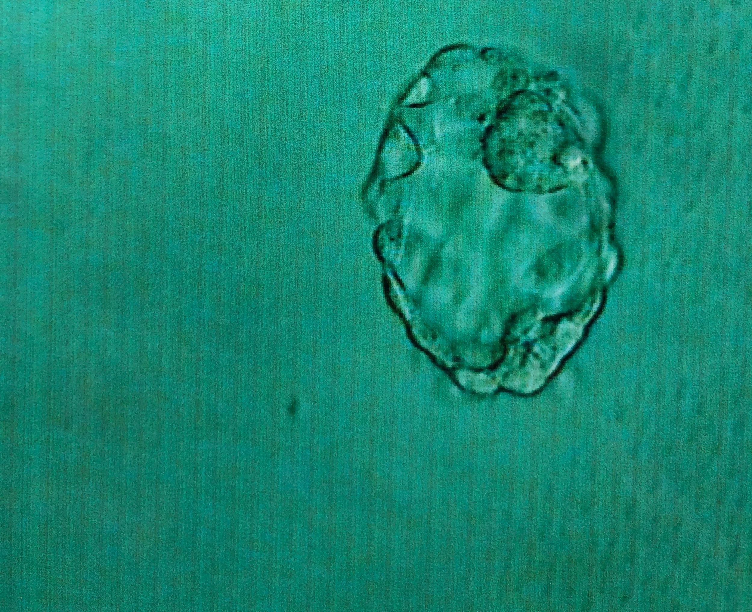 Beta Pregnancy Test #2