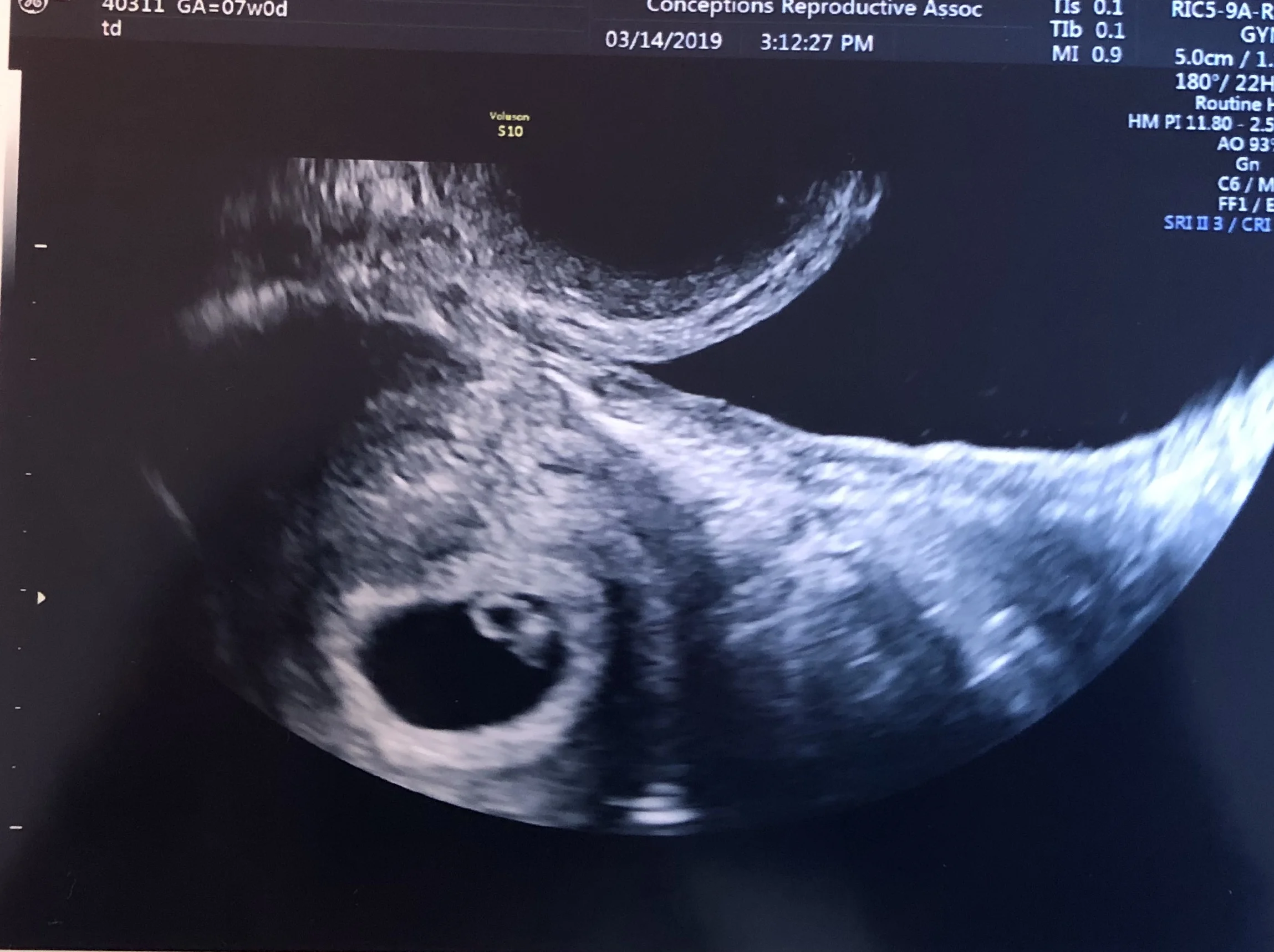 2D ultrasound.jpg