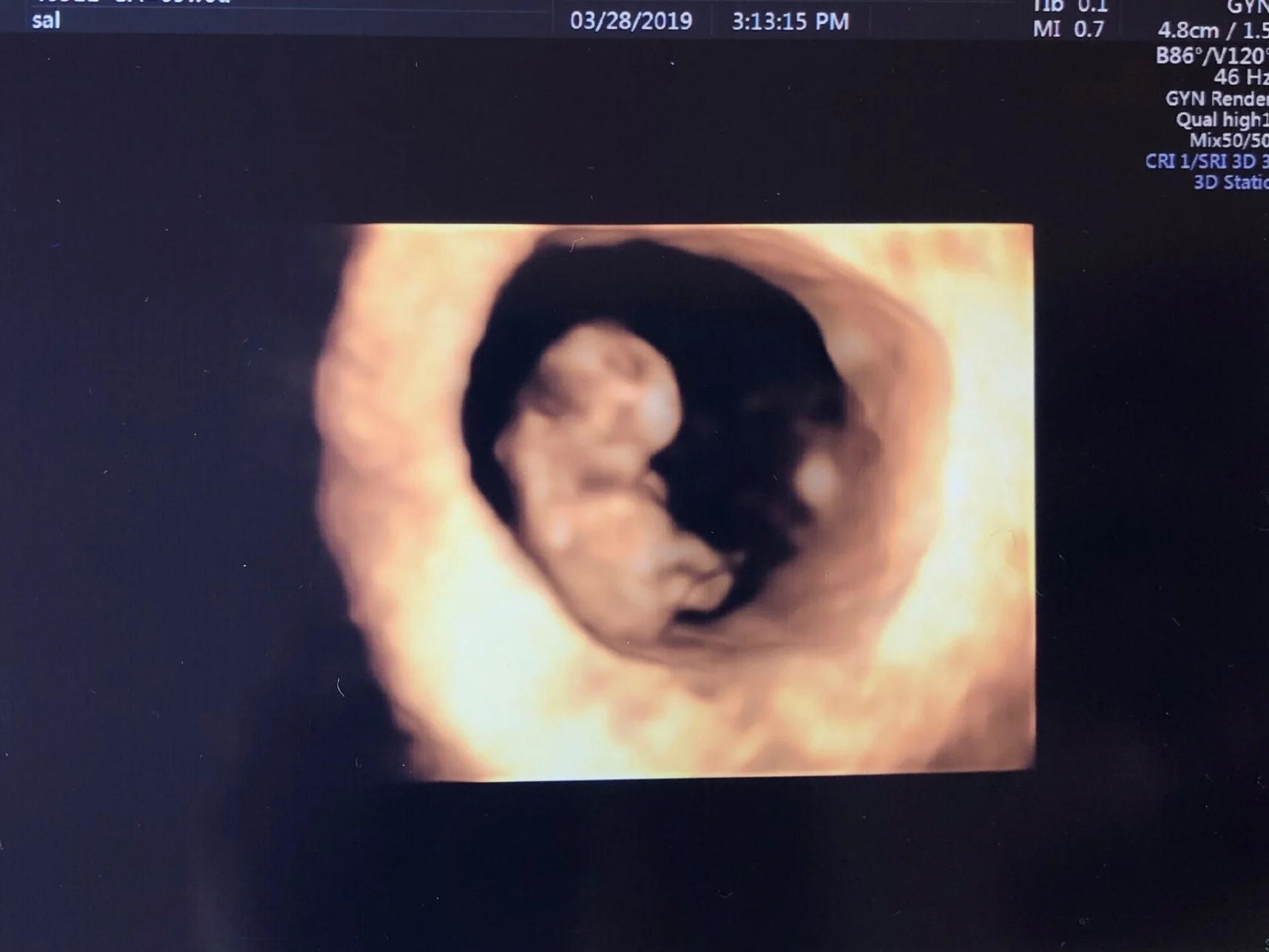 Our baby…in 3D!