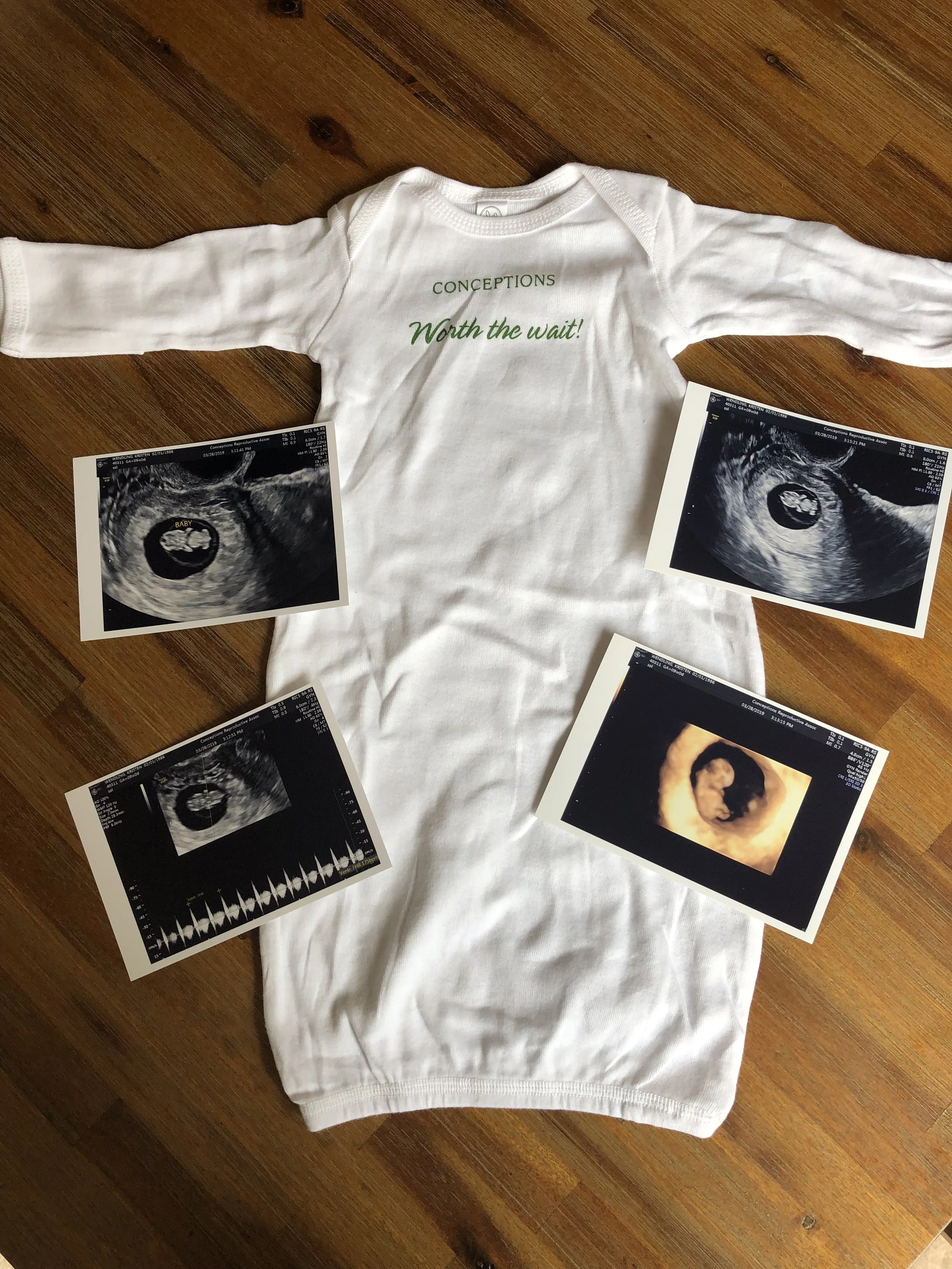 Our little baby will soon be a walking?…crawling?…poopin’ billboard for Conceptions, our fertility clinic. Ha!